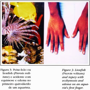 Infecções cutâneas e acidentes por animais traumatizantes e venenosos ocorridos em aquários.