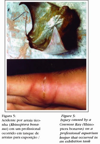 Infecções cutâneas e acidentes por animais traumatizantes e venenosos ocorridos em aquários.