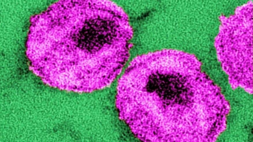 Coral do mar pode ajudar a prevenir a infecção pelo HIV